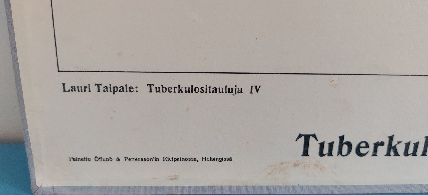 Opetustaulu - Kaaviomainen Kuva Tuberkuloottiset Keuhkot (Tuberkulositauluja IV)