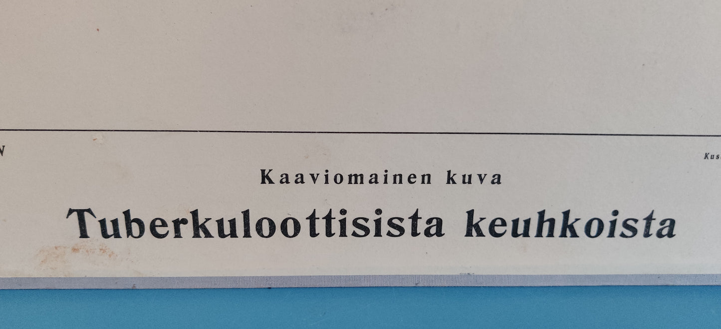 Opetustaulu - Kaaviomainen Kuva Tuberkuloottiset Keuhkot (Tuberkulositauluja IV)