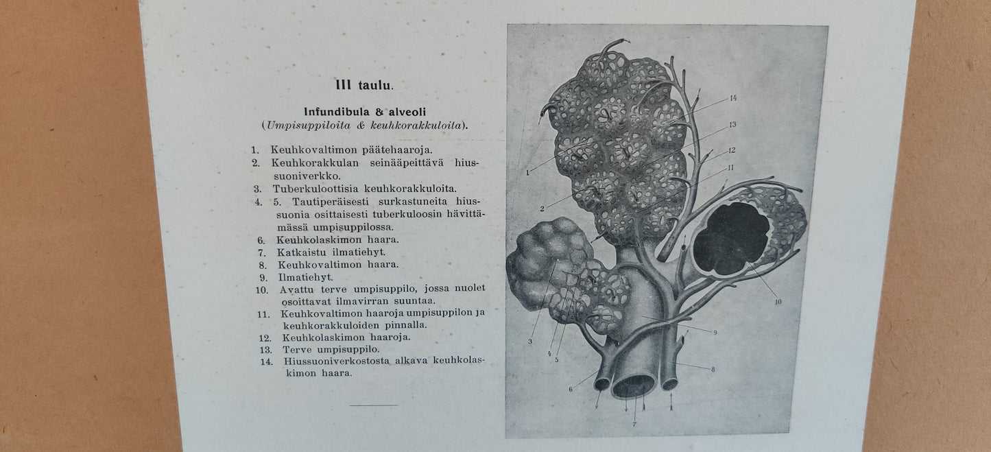 Opetustaulu - Infundibula ja Alveoli (Tuberkulositauluja III)