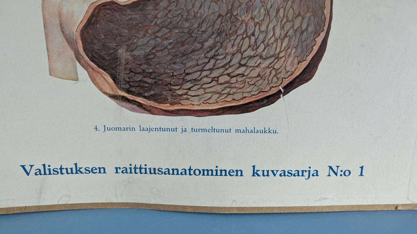 Opetustaulu - Valistuksen Raittiusanatominen Kuvasarja No 1