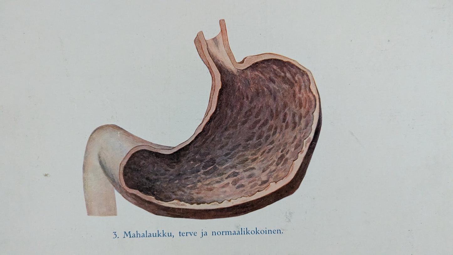 Opetustaulu - Valistuksen Raittiusanatominen Kuvasarja No 1