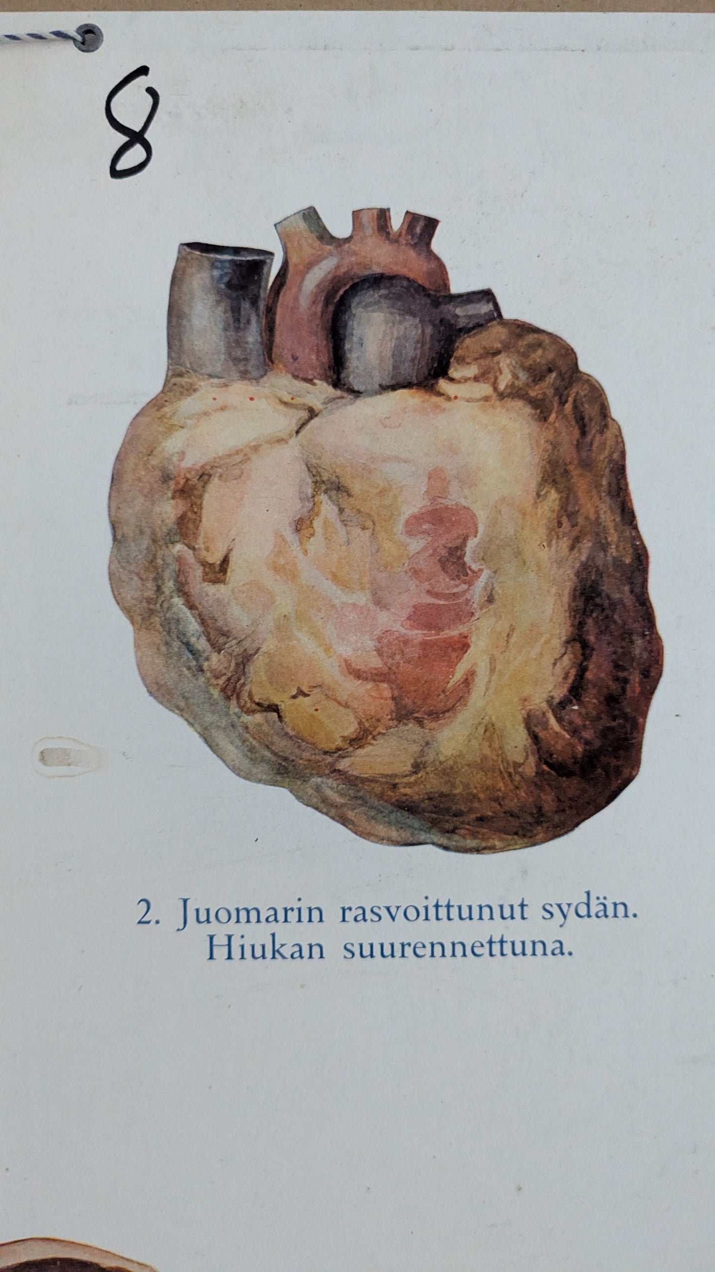 Opetustaulu - Valistuksen Raittiusanatominen Kuvasarja No 1