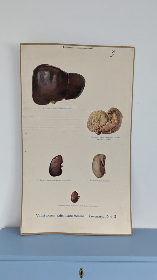 Opetustaulu - Valistuksen Raittiusanatominen Kuvasarja No 2